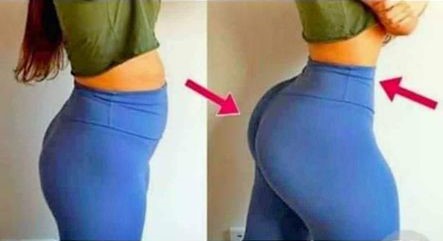 PMMA &Hydrogel Booty injections in Zimbabwe+27 74 676 7021